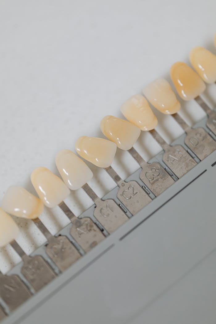 Close-up of a dental shade guide illustrating various tooth color options for dental procedures.